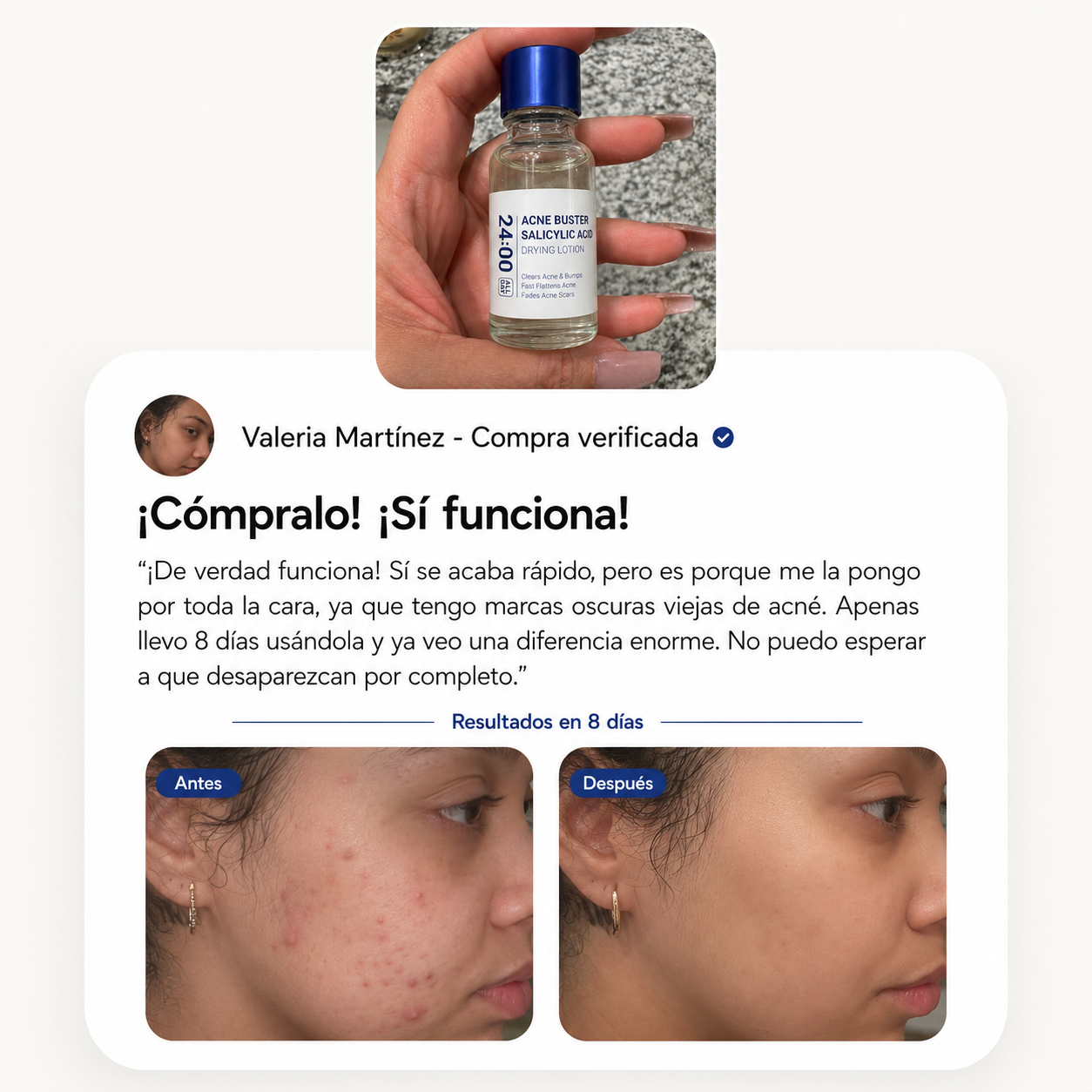 Biora™ - Serum Salicylic Acid